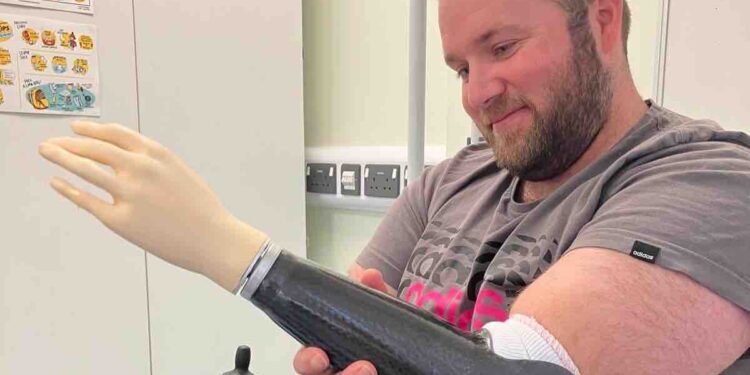 Westbury window cleaner receives new prosthetic arm following 33,000-volt electric shock